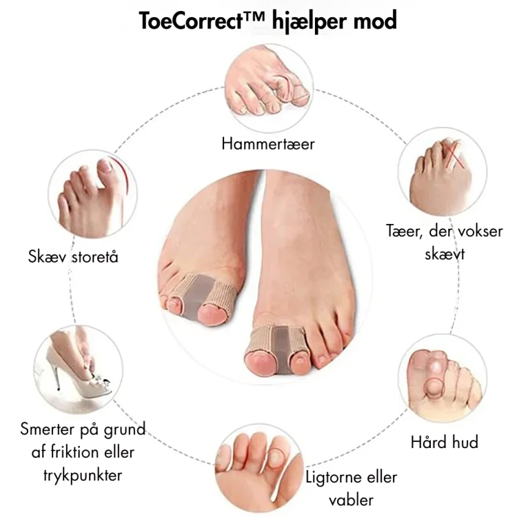 ToeCorrect™ - Verdens førende ikke-kirurgiske tåkorrektor – farvel til knyster og smertefulde skridt