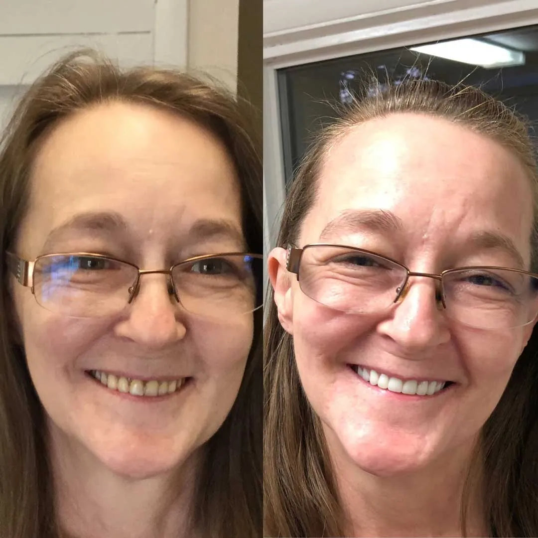 DentFix™ klæbemiddel - Den termoplastiske proteseklæber, der holder tænderne på plads i op til 16 timer uden at falde ud.