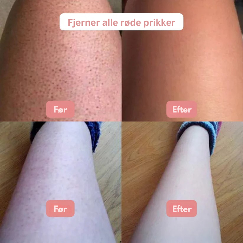 SilkShave™ - For en pletfri, glat hud uden irritation