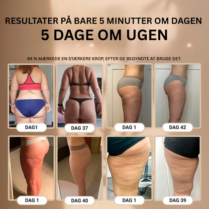 Skinova™ Anti-Cellulite-Massager - Sig farvel til appelsinhud og slap hud