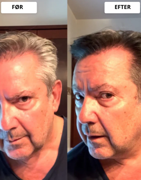 Resultaterne taler for sig selv.