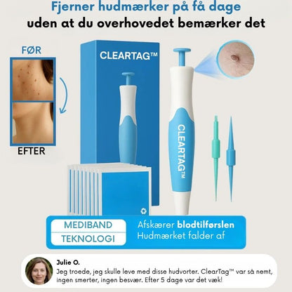 ClearTag™ - Ingen flere hudmærker