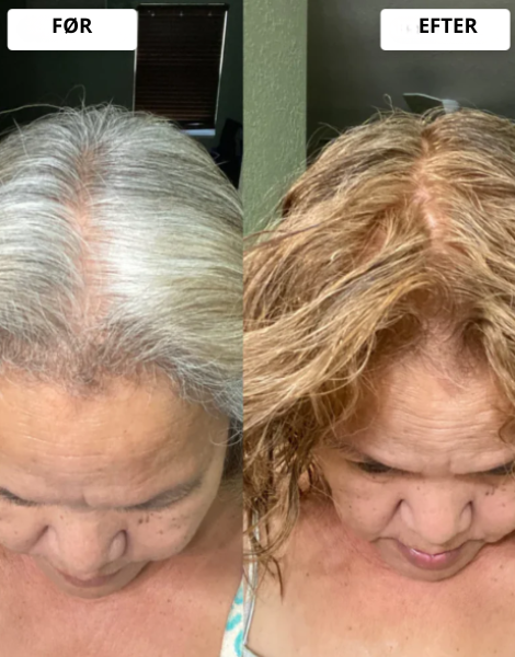 Resultaterne taler for sig selv.