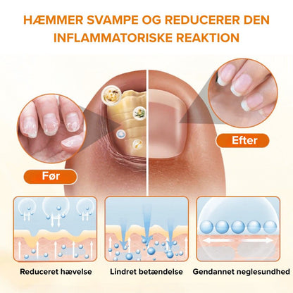 NeglCure™ - 99 % af neglesvampen væk på 7 dage!