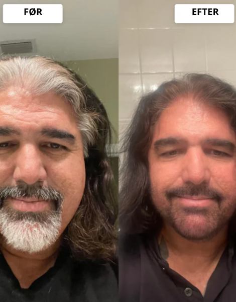 Resultaterne taler for sig selv.