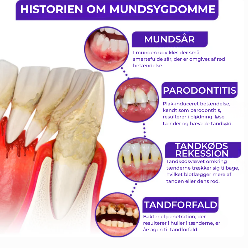 Parodentix™ - Fjerner plak og styrker tandkød naturligt