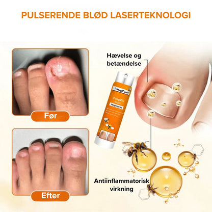 NeglCure™ - 99 % af neglesvampen væk på 7 dage!
