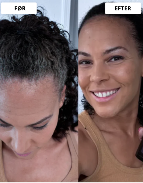 Resultaterne taler for sig selv.