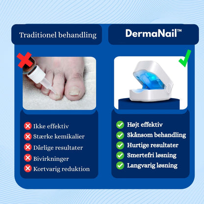 DermaNail™ - Effektiv behandling af svamp i neglene