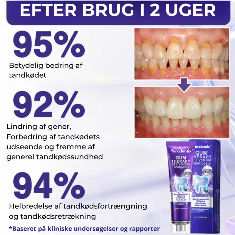 Parodentix™ - Fjerner plak og styrker tandkød naturligt