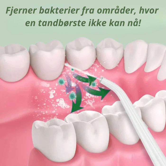 AquaDent™ - Effektiv tandtråd, der forhindrer plak, irritation og bakterier i tandkødet