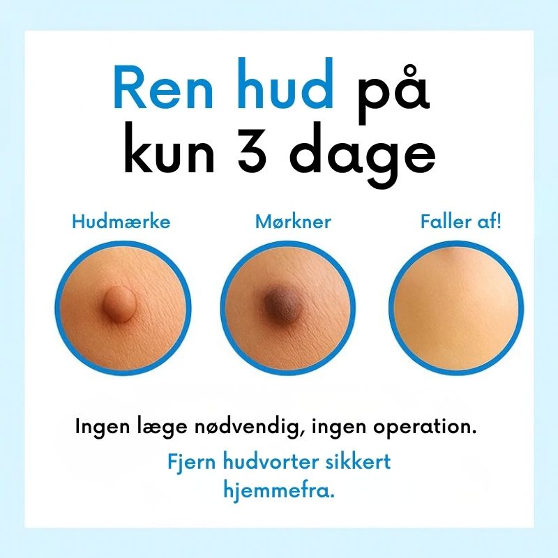 ClearTag™ - Ingen flere hudmærker