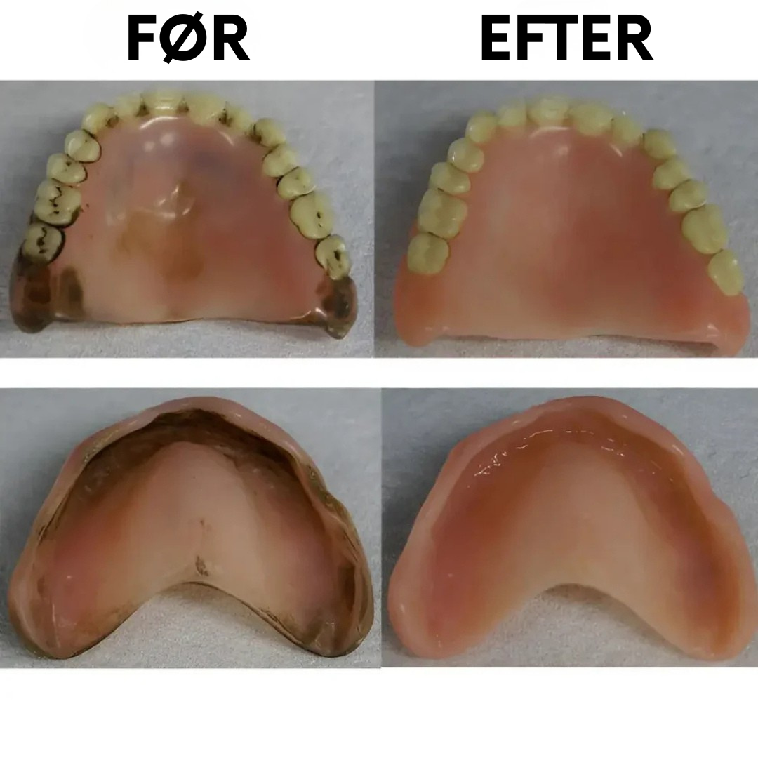 DentalClean™ - Til friske, rene og sikre tandproteser