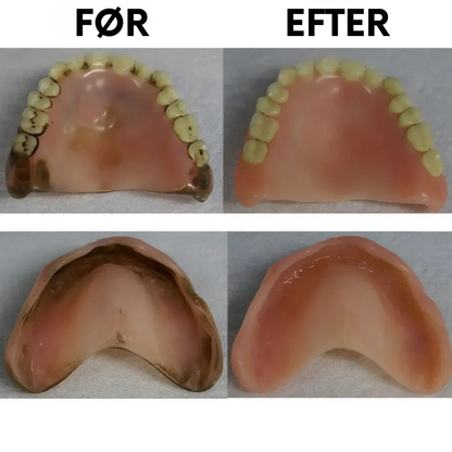 DentalClean™ - Til friske, rene og sikre tandproteser