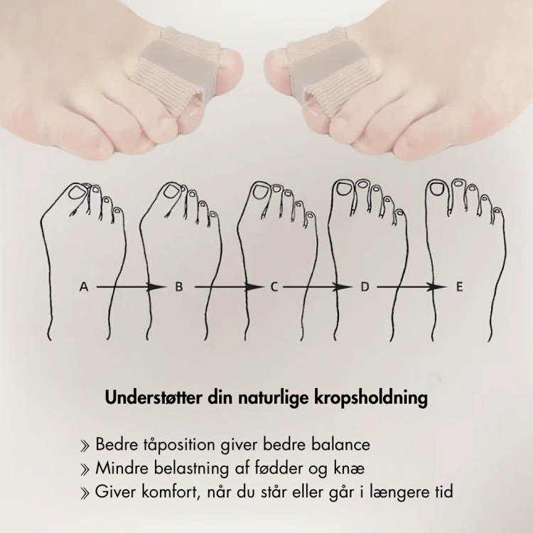 ToeCorrect™ - Verdens førende ikke-kirurgiske tåkorrektor – farvel til knyster og smertefulde skridt