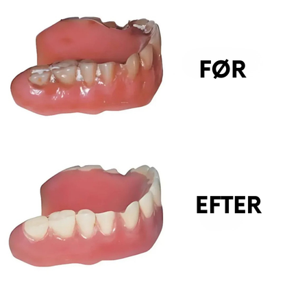 DentalClean™ - Til friske, rene og sikre tandproteser