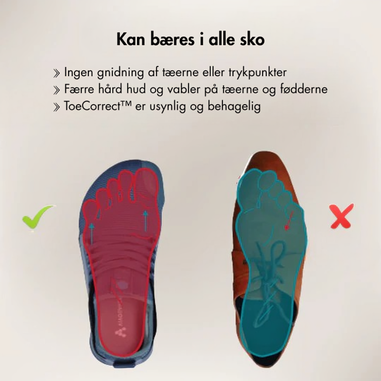 ToeCorrect™ - Verdens førende ikke-kirurgiske tåkorrektor – farvel til knyster og smertefulde skridt