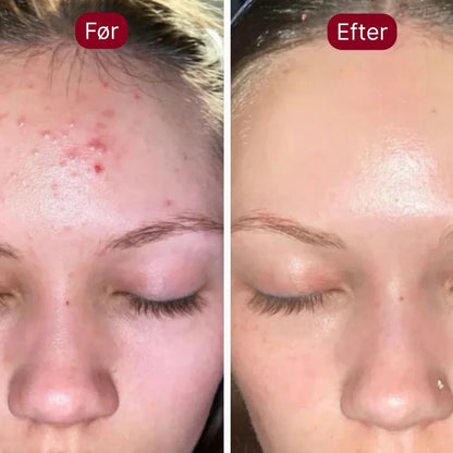 DermaSkin™ Serum Duo - Silkeblød hud på få sekunder