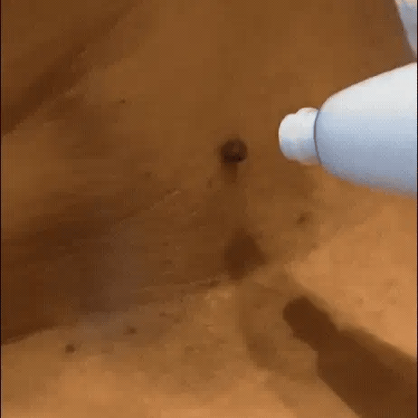 ClearTag™ - Ingen flere hudmærker