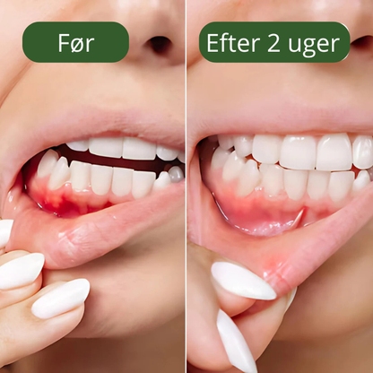 AquaDent™ - Effektiv tandtråd, der forhindrer plak, irritation og bakterier i tandkødet