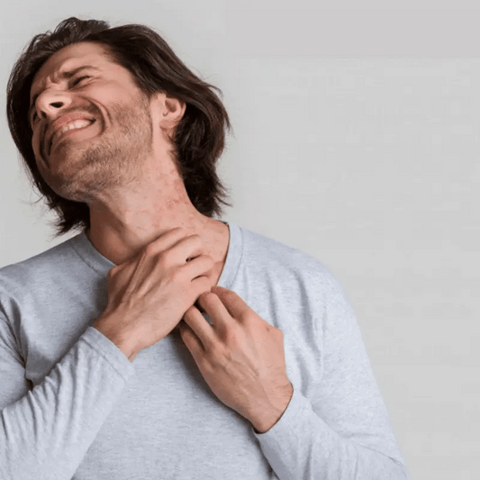 CalmSkin™ - Få langvarig lindring af eksem på bare 5 minutter!