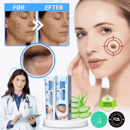Dermacil™ - Fjern op til 95 % af hudlapper og vorter inden for 4 dage